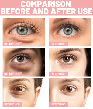 Fading Wrinkle Eye Bag Care