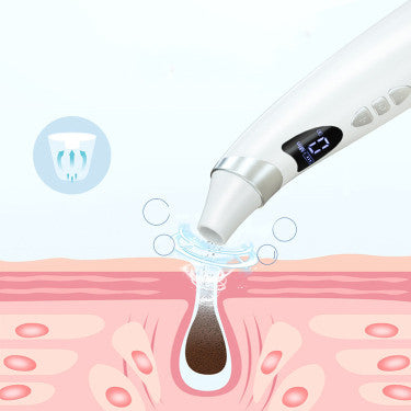 Electric Blackhead Remover – Deep Pore Cleaning & Skin Care Tool