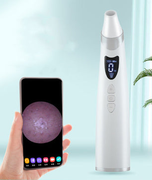 Electric Blackhead Remover – Deep Pore Cleaning & Skin Care Tool
