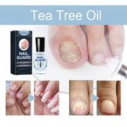 Onyxoguard nail growth and repair serum