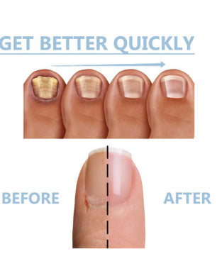 Onyxoguard nail growth and repair serum
