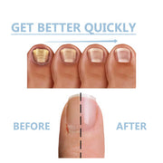 Onyxoguard nail growth and repair serum