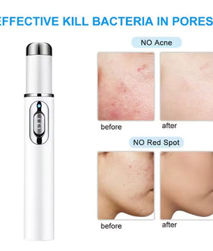Blue Light Therapy Acne Pen Soft Scar Wrinkle Removal Device Relax