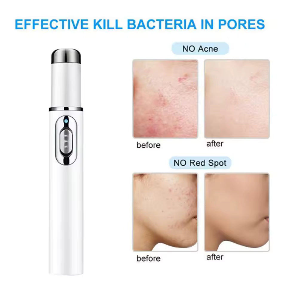 Blue Light Therapy Acne Pen Soft Scar Wrinkle Removal Device Relax
