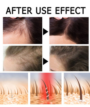 Scalp Strengthening And Repairing Massage Liquid