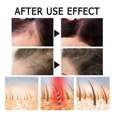 Scalp Strengthening And Repairing Massage Liquid